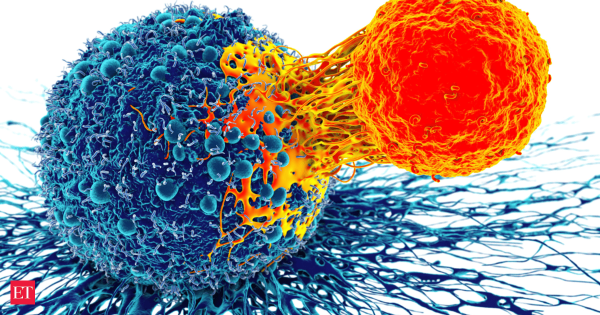 AI Outperforms Doctors in Prostate Cancer Detection, UCLA