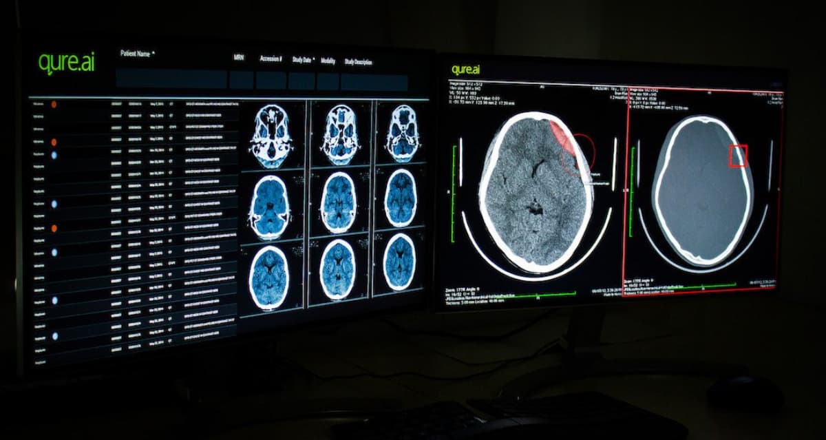 Qure.ai Seeks $50-60 Million Funding to Expand AI-Powered