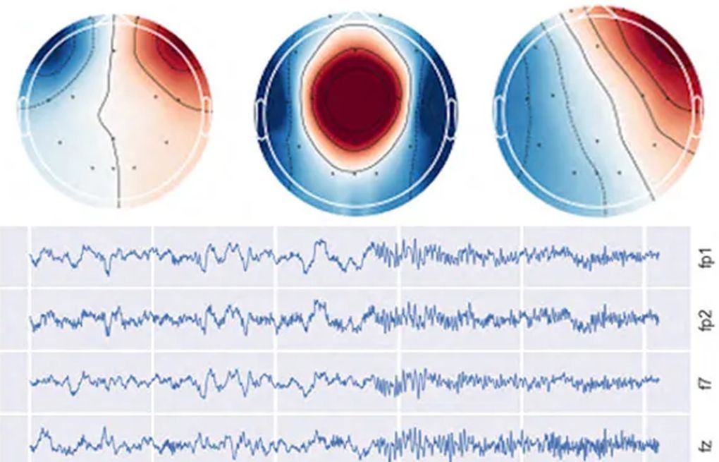 AI Advances in Early Dementia Detection and Brain Health