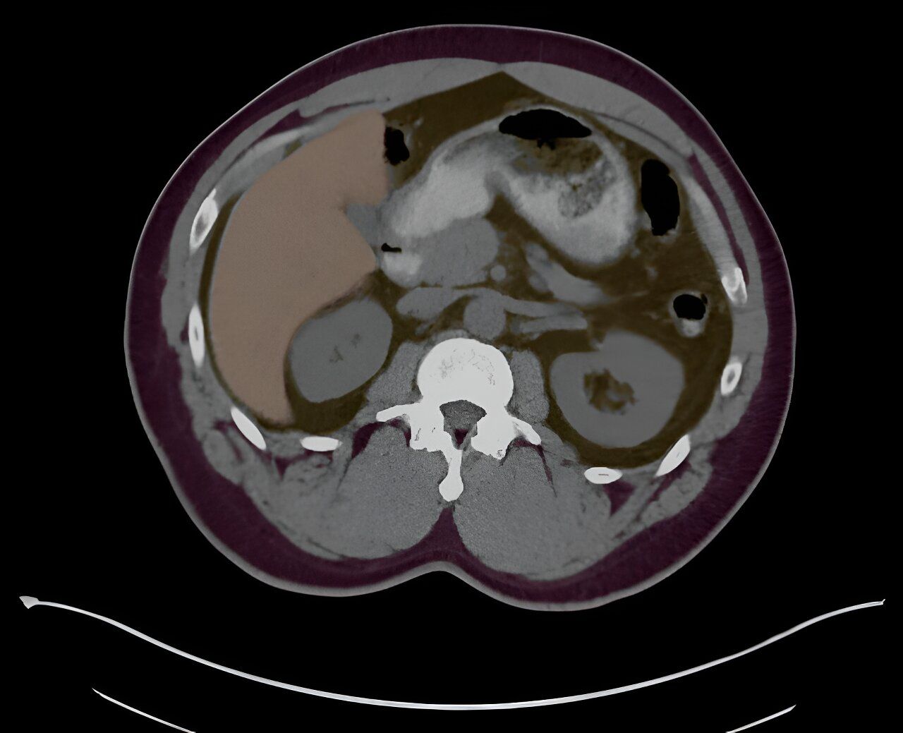 Penn AInSights: AI-Guided Imaging System Revolutionizes