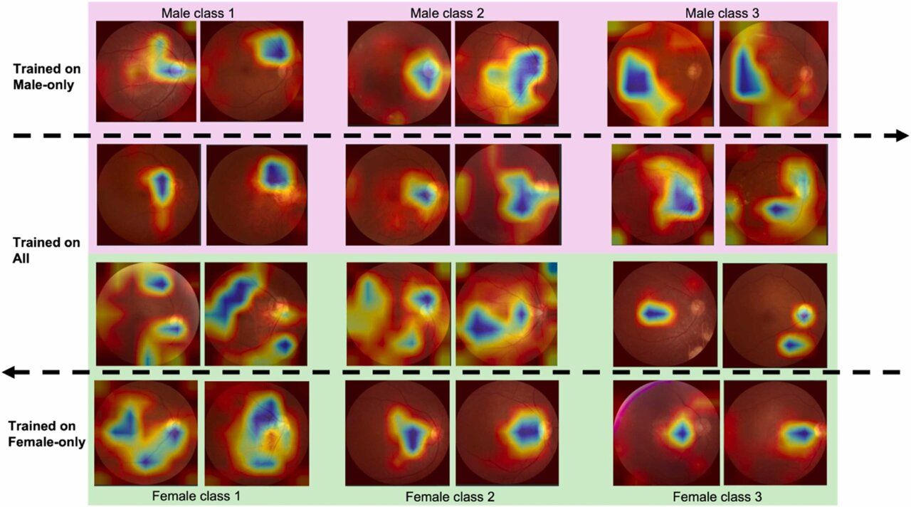 AI-Powered Oculomics: Revolutionizing Cardiovascular Risk