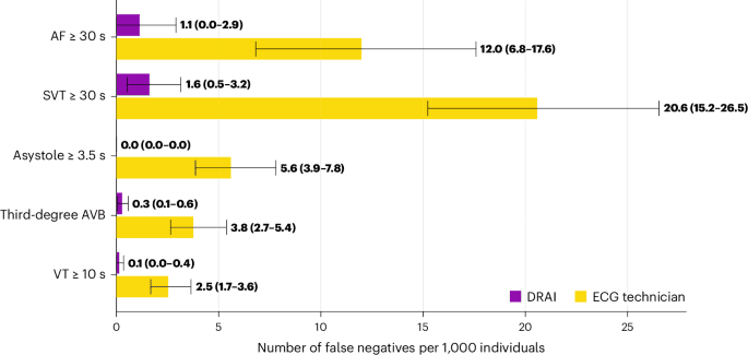 AI Outperforms Humans in Analyzing Long-Term ECG