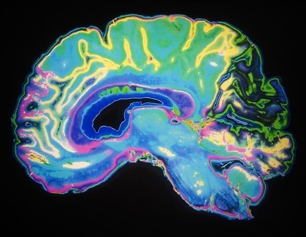 Hybrid AI Approach Enhances Brain Imaging for Surgical