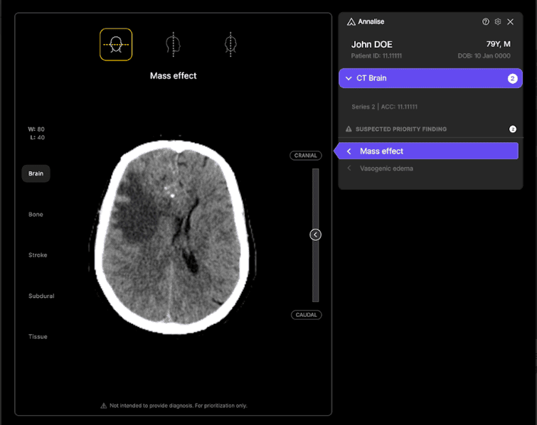 Harrison.ai Secures $112M Series C Funding to Expand