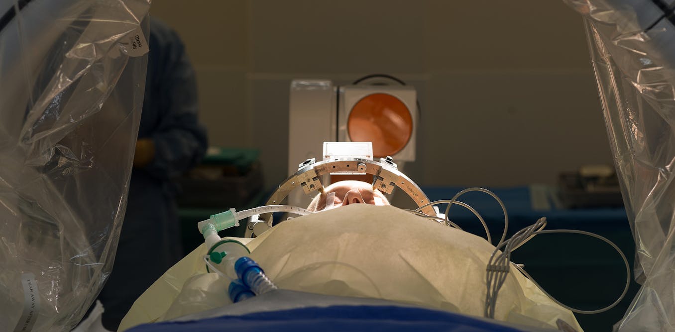 Smart Brain Implants: A Revolutionary Approach to Treating