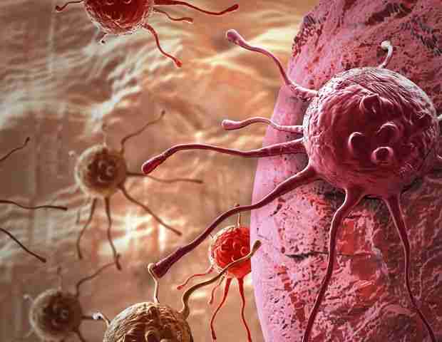 AI Model Revolutionizes Cancer Diagnosis with 99% Accuracy Using Epigenetic Fingerprints