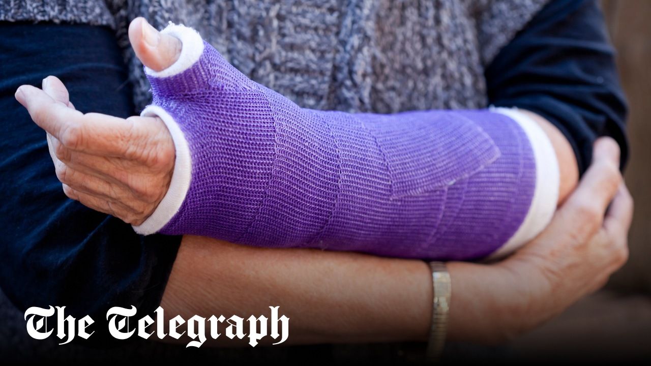 NHS Approves AI-Powered X-ray Analysis to Reduce Missed