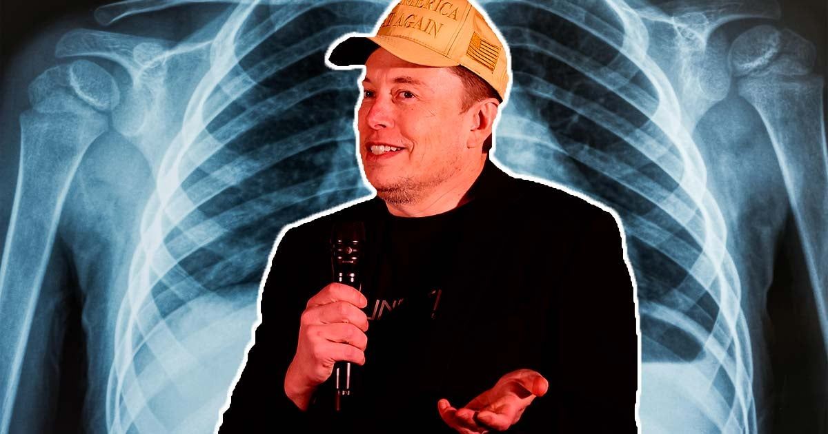 Elon Musk's Grok AI Raises Concerns Over Medical Data