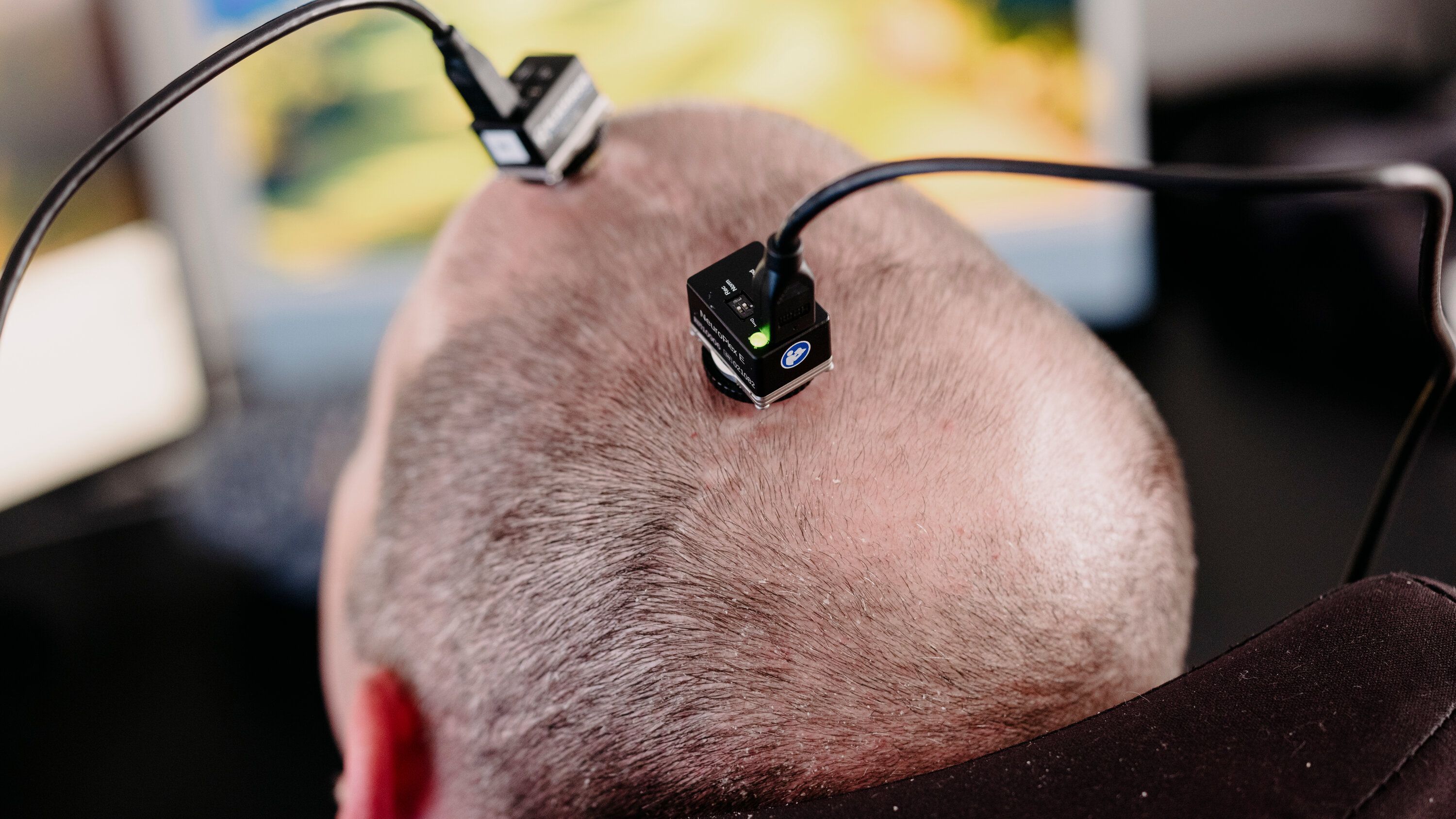 FDA's Device Unit Faces Challenges Amid AI and