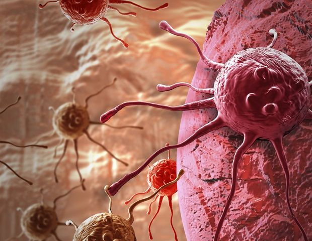 Stanford AI Tool Predicts Cancer Gene Activity from Biopsy