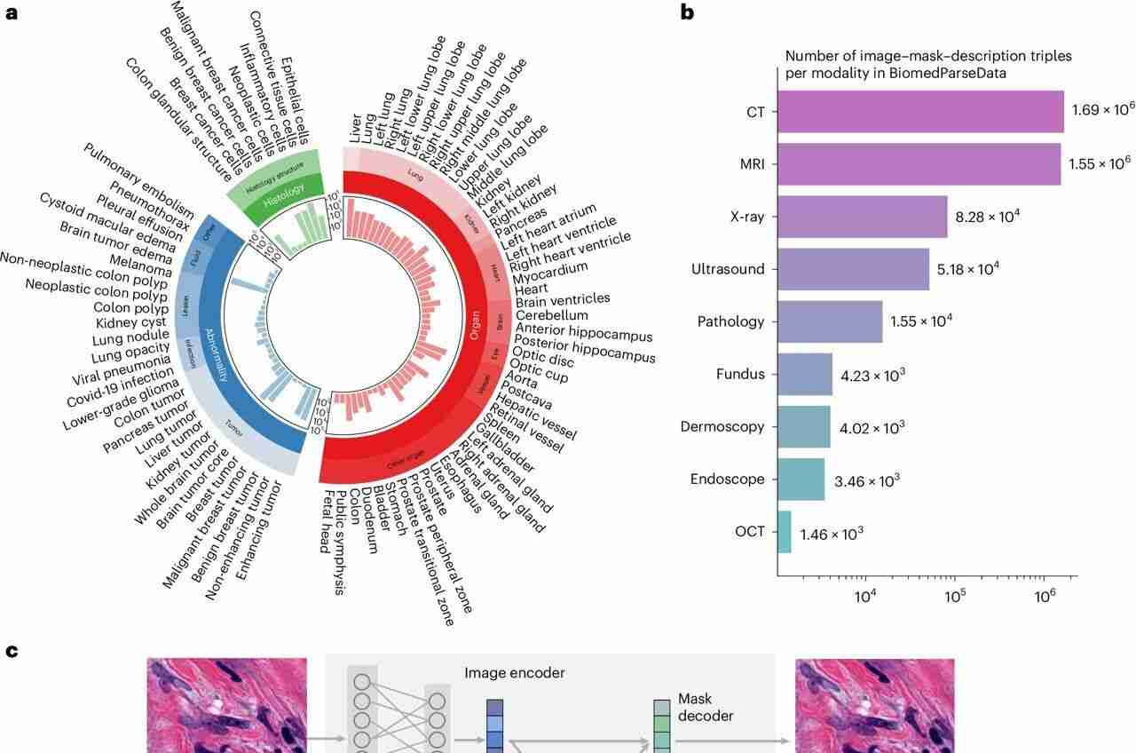 BiomedParse: A Breakthrough AI Model for Analyzing Multiple 