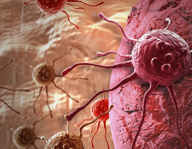 AI detects colorectal cancer with high accuracy