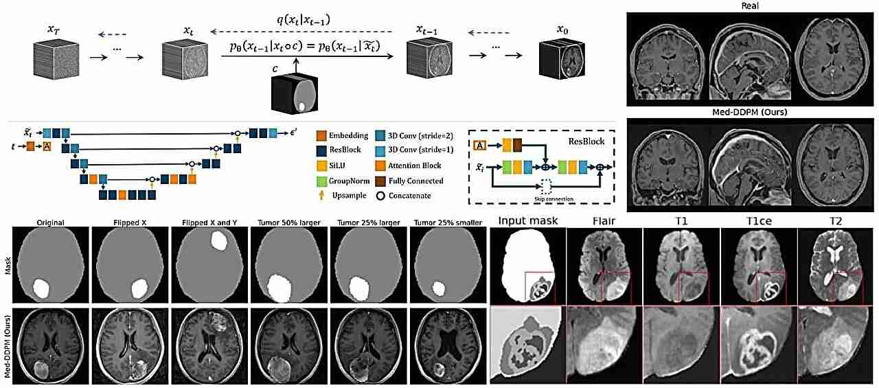 AI model can generate 3D brain MRI images while addressing