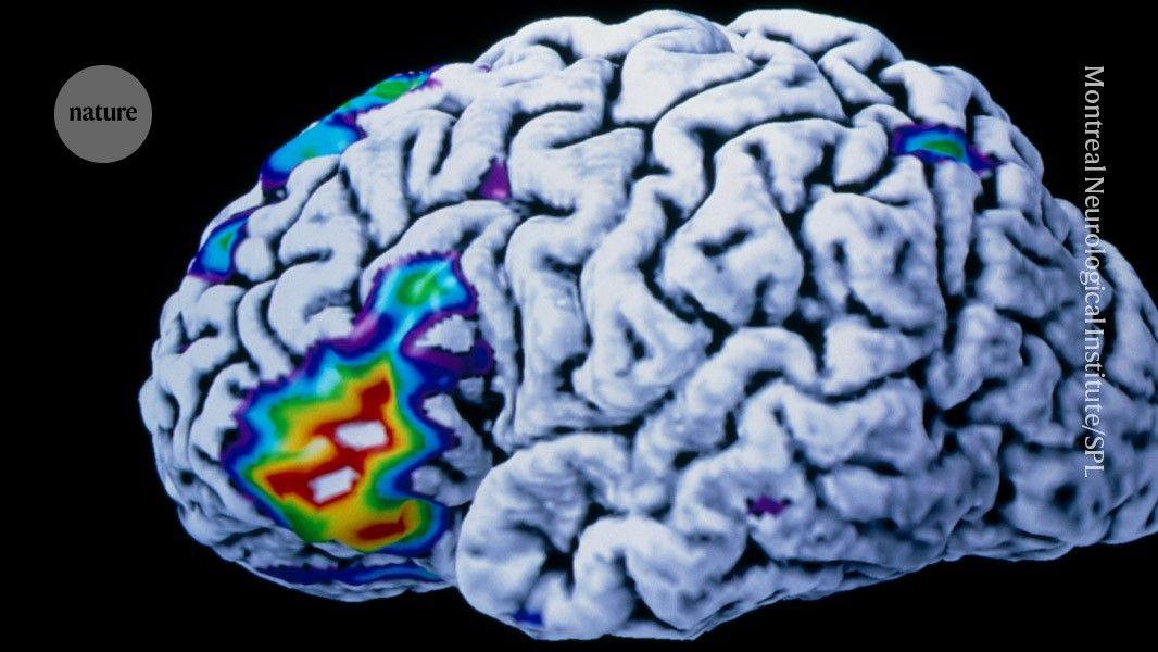 Brain Implant Breakthrough: Real-Time Thought-to-Speech