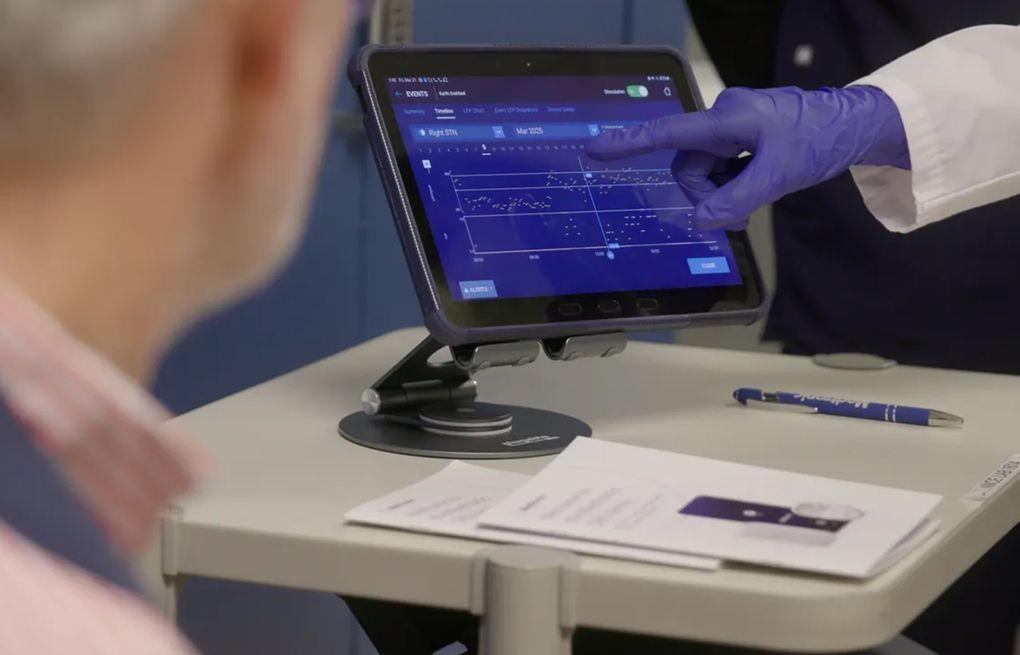 AI-Enhanced Adaptive Deep Brain Stimulation Shows Promise