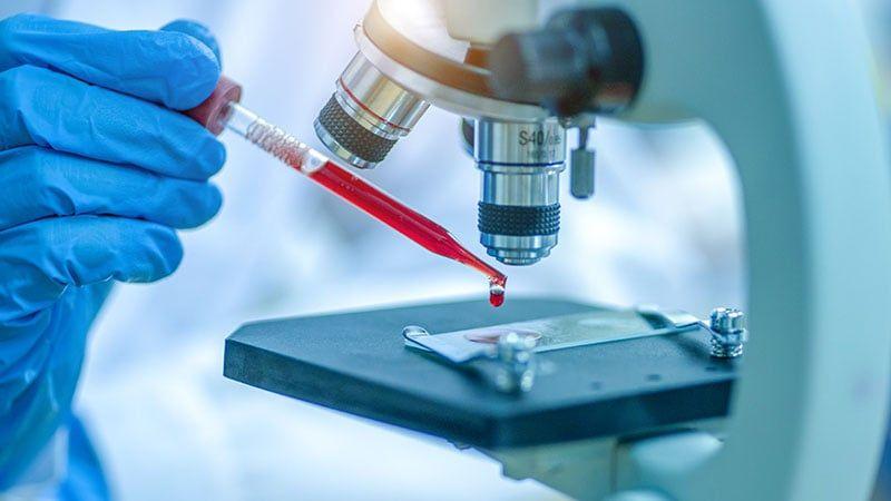 AI-Powered Blood Test for Early Cancer Detection to be