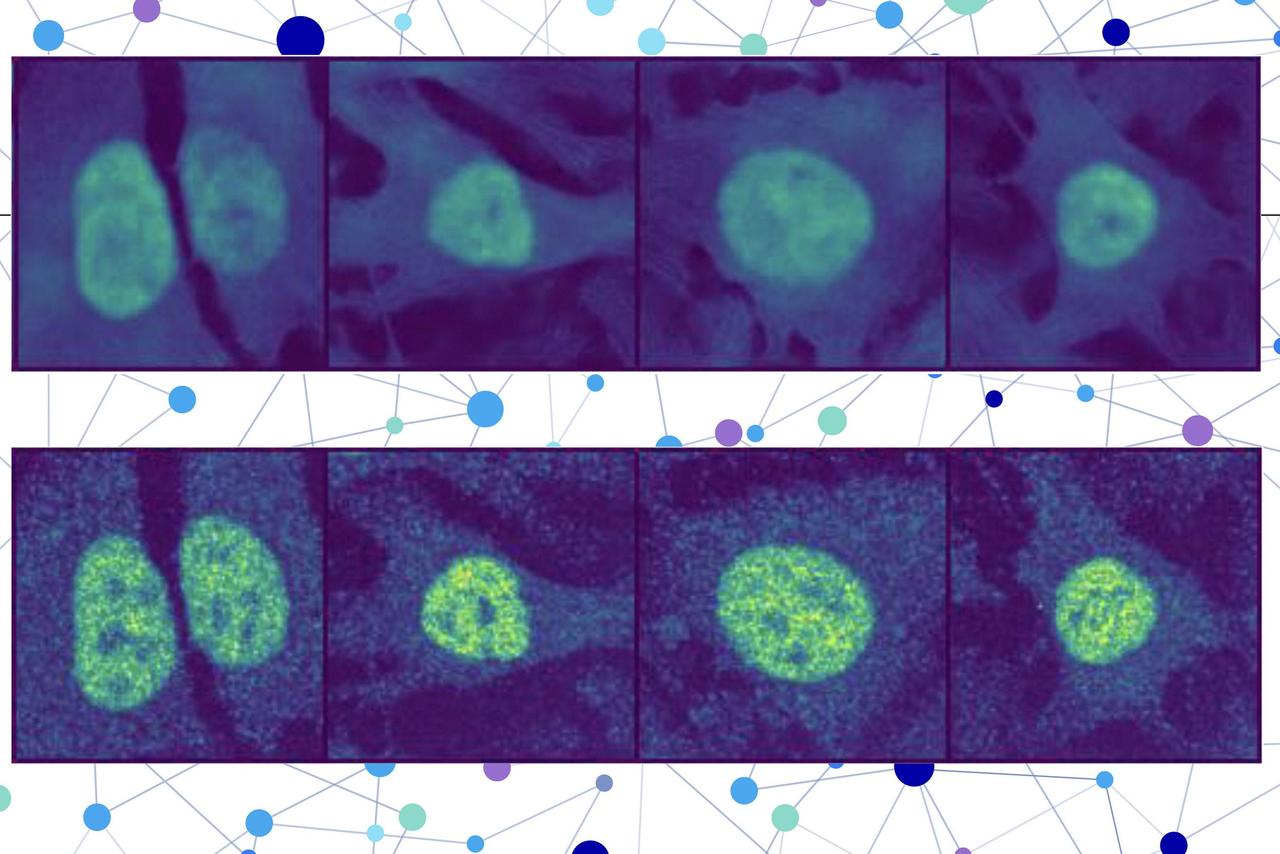 AI Model Predicts Protein Location in Human Cells,