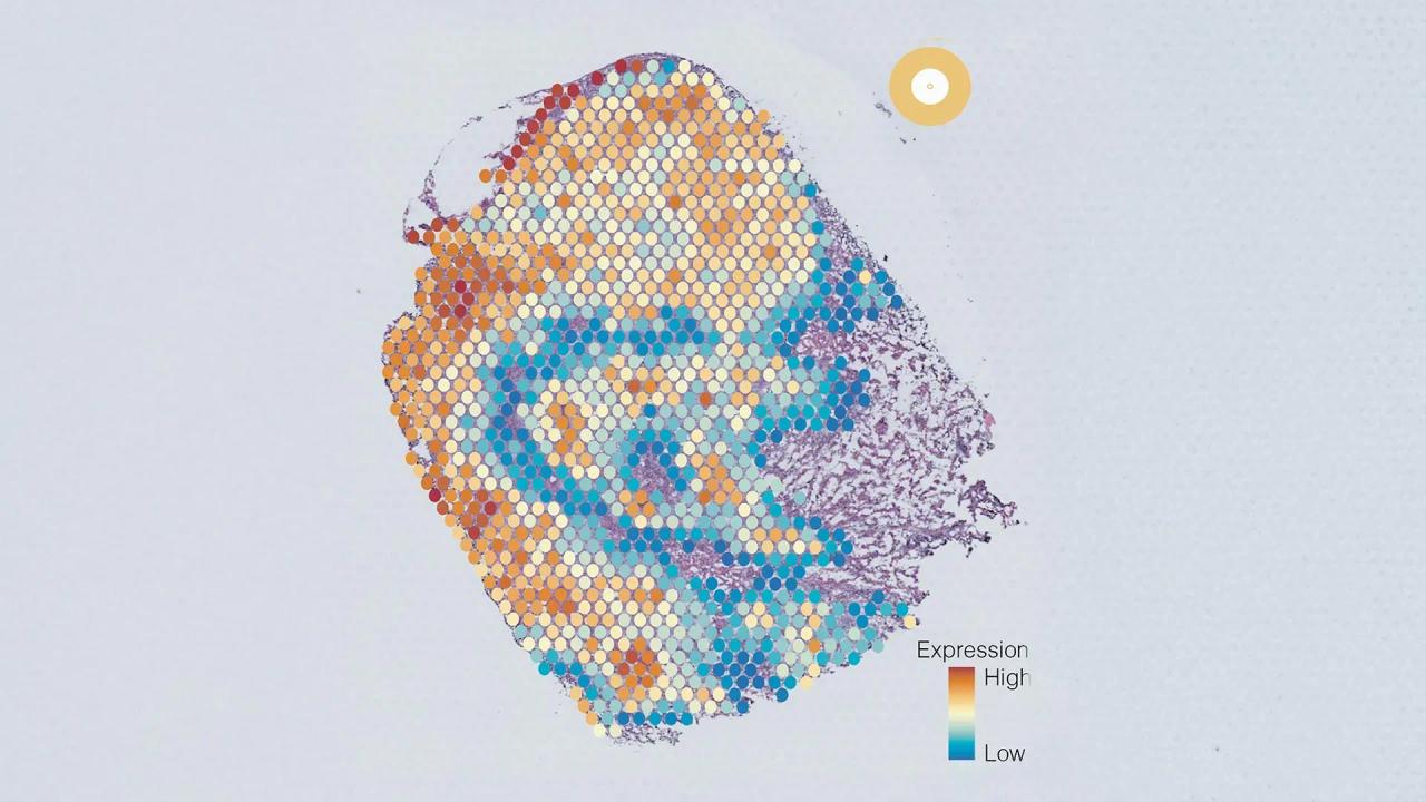 AI Tool Uncovers Five Distinct Cancer Cell Groups,