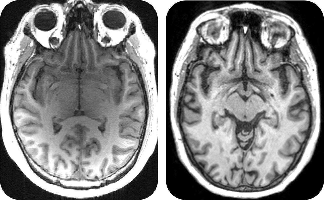 Source: Medical Xpress