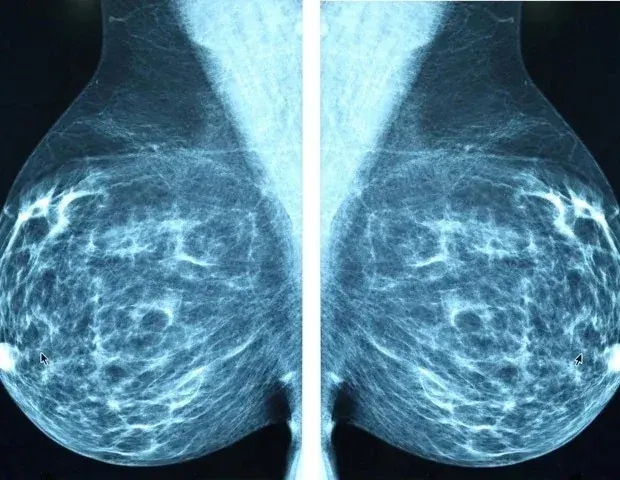 Source: News-Medical